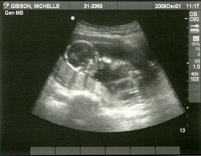 Ultrasound12-1-090001.jpg