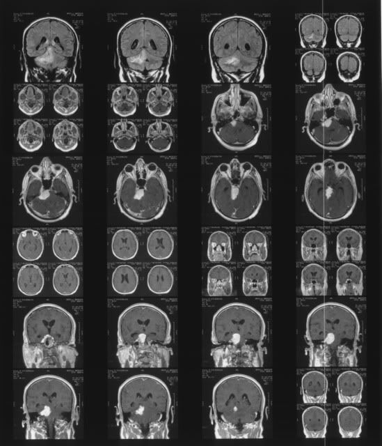 mri02.jpg picture by dorinfather